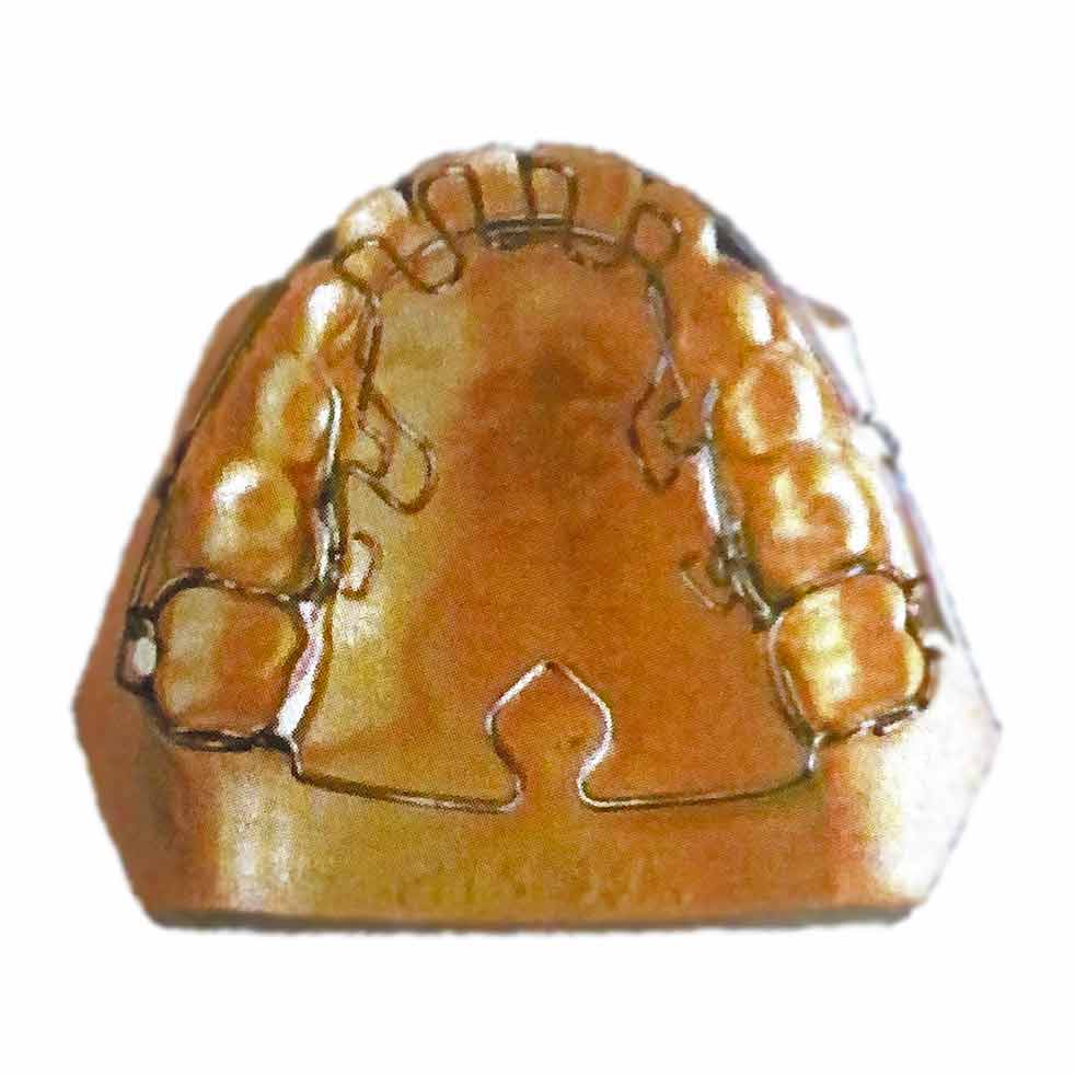 Tecnica di Crozat · esempio 2